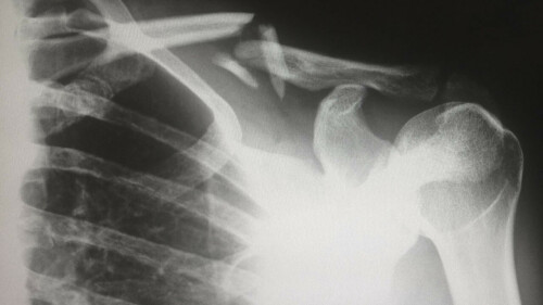 personal-injury-law-firm-corona.jpg