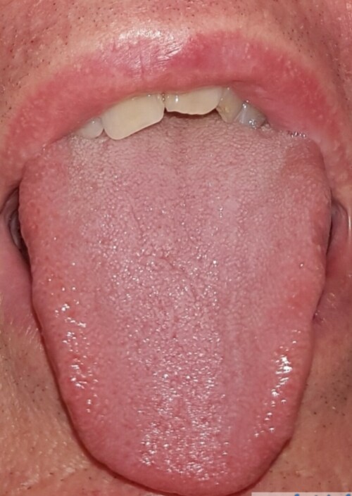 20230715_083232.jpg