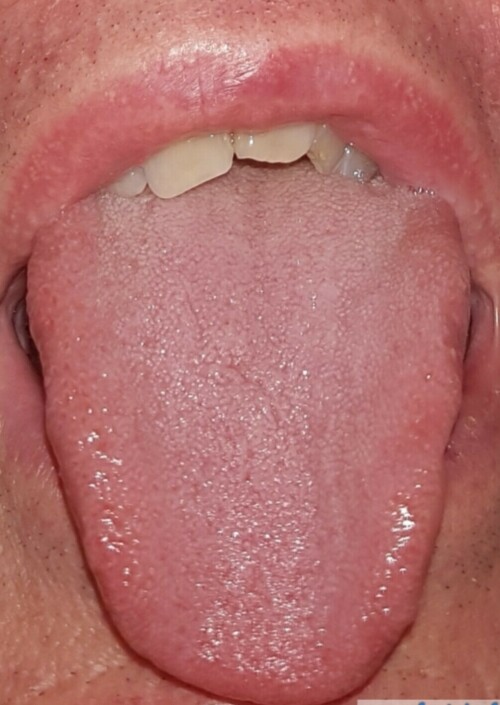 20230715_083232.jpg