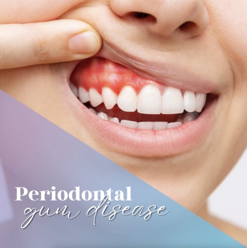 Periodontist-Hollywood-FL.jpg