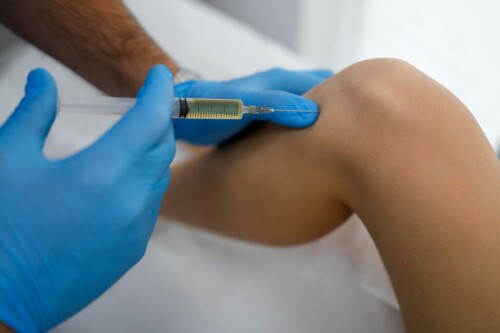 benefits-prp-1-1024x683.jpg